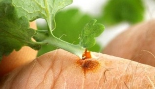 How to remove warts with celandine